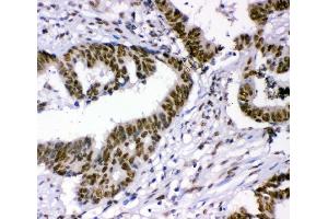 IHC analysis of p95 NBS1 using anti-p95 NBS1 antibody (ABIN3043282). (Nibrin 抗体  (C-Term))