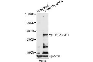 Western blot analysis of extracts of HeLa cells, using Phospho-RELA-S311 antibody (ABIN5969962) at 1/2000 dilution. (NF-kB p65 抗体  (pSer311))