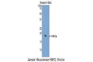 Western Blotting (WB) image for anti-Retinol Binding Protein 2, Cellular (RBP2) (AA 1-134) antibody (ABIN1860412) (RBP2 抗体  (AA 1-134))