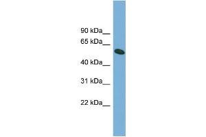 WB Suggested Anti-OMA1 Antibody Titration: 0. (OMA1 抗体  (Middle Region))