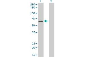 Western Blotting (WB) image for anti-Serine--tRNA Ligase, Cytoplasmic-Like (AA 1-515) antibody (ABIN598916) (Serine--tRNA Ligase, Cytoplasmic-Like (AA 1-515) 抗体)