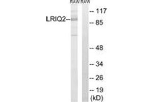 Western blot analysis of extracts from RAW264. (CEP97 抗体  (AA 581-630))