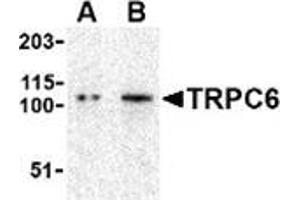 Western blot analysis of TRPC6 in K562 cell lysate with this product at (A) 0.