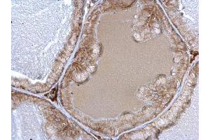 IHC-P Image alpha 1a Adrenergic Receptor antibody detects alpha 1a Adrenergic Receptor protein at cytosol on mouse prostate by immunohistochemical analysis. (alpha 1 Adrenergic Receptor 抗体)