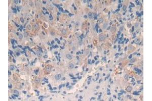 Immunohistochemistry (IHC) image for anti-Cytochrome P450, Family 11, Subfamily A, Polypeptide 1 (CYP11A1) (AA 329-526) antibody (ABIN5013425)