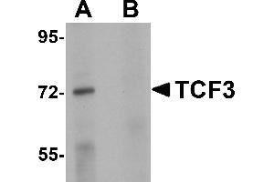 Western Blotting (WB) image for anti-Transcription Factor 3 (E2A Immunoglobulin Enhancer Binding Factors E12/E47) (TCF3) (N-Term) antibody (ABIN1031605) (TCF3 抗体  (N-Term))