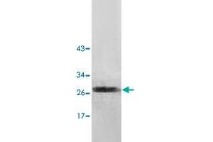 Western blot analysis of human fetal brain lysate with NUDT7 polyclonal antibody  at 1 : 500 dilution. (NUDT7 抗体  (AA 2-236))