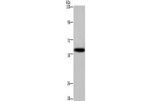 Western Blotting (WB) image for anti-Potassium Voltage-Gated Channel, Subfamily G, Member 4 (Kcng4) antibody (ABIN2433243) (KCNG4 抗体)