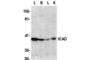 Western blot analysis of ICAD in mouse lung (L), brain (B), liver (L), and kidney tissue lysate with AP30399PU-N CAD antibody at 1/1000 dilution. (DFFA 抗体  (C-Term))