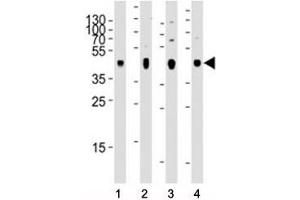 Western blot analysis of lysate from 1) human skeletal muscle, 2) human brain, 3) mouse brain, and 4) rat brain tissue using PDK2 antibody at 1:2000 for each lane. (PDK2 抗体)