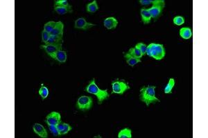 Immunofluorescent analysis of MCF-7 cells using ABIN7161370 at dilution of 1:100 and Alexa Fluor 488-congugated AffiniPure Goat Anti-Rabbit IgG(H+L) (GPM6A 抗体  (AA 149-213))