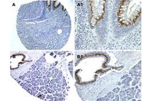 Formalin-fixed, paraffin-embedded sections of human colon (A, A1) and pancreas (B, B1) stained for NOD1 expression. (NOD1 抗体)