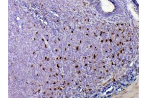 IHC analysis of IL33 using anti-IL33 antibody . (IL-33 抗体  (AA 102-264))