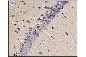 IHC analysis of Dynamin 3/DNM3 using anti-Dynamin 3/DNM3 antibody (ABIN7601163).