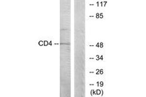 Western blot analysis of extracts from COLO205 cells, using CD4 (Ab-433) Antibody. (CD4 抗体  (AA 401-450))