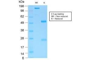 SDS-PAGE analysis of purified, BSA-free recombinant Gastric Mucin antibody (clone MUC6/1553R) as confirmation of integrity and purity. (MUC6 抗体)