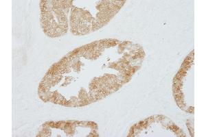 Immunohistochemistry (IHC) image for anti-Stratifin (SFN) (AA 198-248) antibody (ABIN7448925) (14-3-3 sigma/SFN 抗体  (AA 198-248))