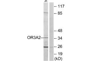 Western blot analysis of extracts from Jurkat cells, using OR3A2 antibody. (OR3A2 抗体  (C-Term))