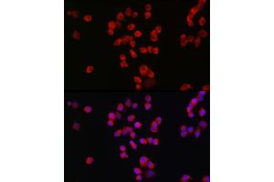 Immunofluorescence (IF) image for anti-Glutamate Receptor, Ionotropic, N-Methyl D-Aspartate 2B (GRIN2B) (C-Term) antibody (ABIN3017276)