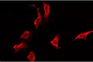 ABIN6276171 staining Hela by IF/ICC. (OR5K3 抗体  (Internal Region))