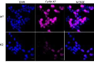 Immunocytochemical staining of HeLa cells using Cyclin A2 antibody (ABIN7798186), 1:1,000), Top panel: wild-type (WT), Bottom panal: Cyclin A2 shRNA knockdown (KD). (Recombinant Cyclin A 抗体)