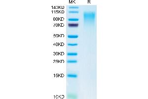 CD164 Protein (CD164) (AA 24-162) (Fc Tag)