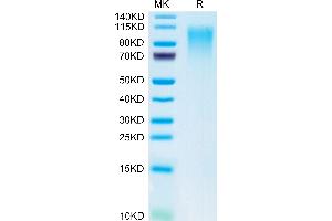 Mouse CD164 on Tris-Bis PAGE under reduced condition. (CD164 Protein (CD164) (AA 24-162) (Fc Tag))