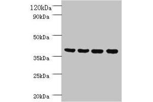 Western blot All lanes: Prootein FAM110B antibody at 2 μg/mL Lane 1: Mouse sexual gland tissue Lane 2: HepG2 whole cell lysate Lane 3: Mouse spleen tissue Lane 4: A431 whole cell lysate Secondary Goat polyclonal to rabbit IgG at 1/10000 dilution Predicted band size: 41 kDa Observed band size: 41 kDa (TMEM185B 抗体  (AA 1-370))