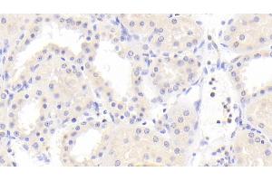 Detection of PCK2 in Human Kidney Tissue using Polyclonal Antibody to Phosphoenolpyruvate Carboxykinase 2, Mitochondrial (PCK2) (PEPCK 抗体  (AA 33-198))
