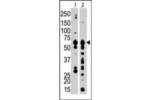 The PFKFB3 polyclonal antibody  is used in Western blot to detect PFKFB3 in Jurkat cell lysate (Lane 1) and mouse brain tissue lysate (Lane 2) . (PFKFB3 抗体  (C-Term))