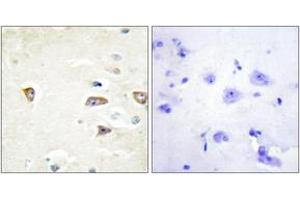 Immunohistochemistry analysis of paraffin-embedded human brain tissue, using MRCKB Antibody. (CDC42BPB 抗体  (AA 1641-1690))