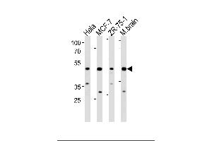 FBXO28 Antibody (C-term) (ABIN1881338 and ABIN2843372) western blot analysis in Hela,MCF-7,ZR-75-1 cell line and mouse brain lysates (35 μg/lane). (FBXO28 抗体  (C-Term))