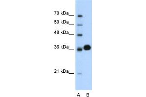 WB Suggested Anti-CDK6 Antibody Titration:  0. (CDK6 抗体  (C-Term))