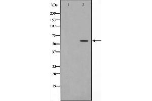 Western blot analysis on HeLa cell lysate using Dyskerin Antibody,The lane on the left is treated with the antigen-specific peptide. (DKC1 抗体  (Internal Region))