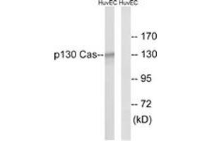 Western blot analysis of extracts from HuvEc cells, using p130 Cas (Ab-410) Antibody. (BCAR1 抗体  (AA 376-425))
