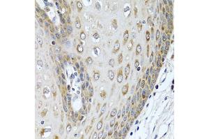 Immunohistochemistry of paraffin-embedded human esophagus using LRG1 antibody (ABIN5975207) at dilution of 1/100 (40x lens). (LRG1 抗体)