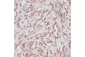 Immunohistochemistry of paraffin-embedded human uterus using RP/RP/RP antibody (ABIN6128653, ABIN6147083, ABIN6147084 and ABIN6214011) at dilution of 1:100 (40x lens). (RPA1 抗体  (AA 1-240))