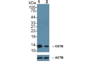 Knockout Varification: ;Lane 1: Wild-type HepG2 cell lysate; ;Lane 2: CSTB knockout HepG2 cell lysate; ;Predicted MW: 11kDa ;Observed MW: 14kDa;Primary Ab: 2µg/ml Rabbit Anti-Human CSTB Antibody;Second Ab: 0. (CSTB 抗体  (AA 1-98))