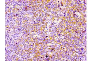 Immunohistochemistry (IHC) image for anti-Complement Component (3d/Epstein Barr Virus) Receptor 2 (CR2) antibody (ABIN7127277)