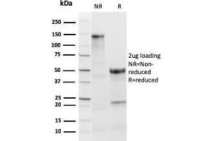 SDS-PAGE Analysis Purified TPO Recombinant Rabbit Monoclonal Antibody (TPO/3813R). (Recombinant TPO (AA 685-804) 抗体)