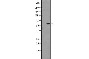 Western blot analysis of GPR148 expression in HT29 cell lysate ;,The lane on the left is treated with the antigen-specific peptide. (GPR148 抗体)