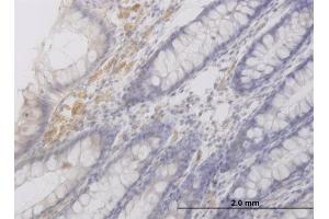 Immunoperoxidase of monoclonal antibody to RAB42 on formalin-fixed paraffin-embedded human colon. (RAB42 抗体  (AA 46-105))