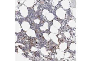 Immunohistochemical staining of human bone marrow with FBXO43 polyclonal antibody  shows strong cytoplasmic positivity in subsets of bone marrow poietic cells.