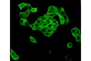 Detection of TTK in MCF7 cells using Polyclonal Antibody to TTK Protein Kinase (TTK) (Mps1 抗体  (AA 532-786))