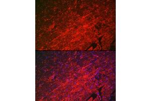 Immunofluorescence (IF) image for anti-Heat Shock 22kDa Protein 8 (HSPB8) (AA 1-196) antibody (ABIN3016167)