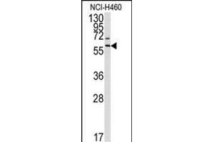 Western blot analysis of anti-P17 Antibody (Center) (ABIN390141 and ABIN2840645) in NCI- cell line lysates (35 μg/lane). (MMP17 抗体  (AA 391-420))