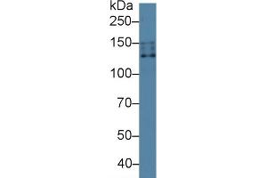 Detection of NCCT in Human 293T cell lysate using Polyclonal Antibody to Na-Cl Cotransporter (NCCT) (SLC12A3 抗体  (AA 3-146))