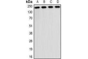 Western blot analysis of CD35 expression in A549 (A), NIH3T3 (B), mouse liver (C), mouse brain (D) whole cell lysates. (CD35 抗体)
