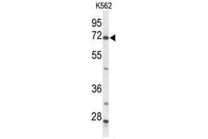 Western blot analysis of ACSS2 Antibody (N-term) in K562 cell line lysates (35 µg/lane). (ACSS2 抗体  (N-Term))