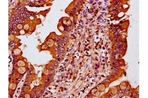 IHC image of ABIN7159553 diluted at 1:400 and staining in paraffin-embedded human small intestine tissue performed on a Leica BondTM system. (MTSS1 抗体  (AA 616-730))
